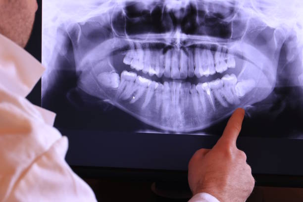 Best Emergency Dental Services for Seniors in Spring Arbor, MI