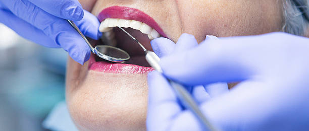 Best Broken or Cracked Tooth Emergency Dentist in Spring Arbor, MI